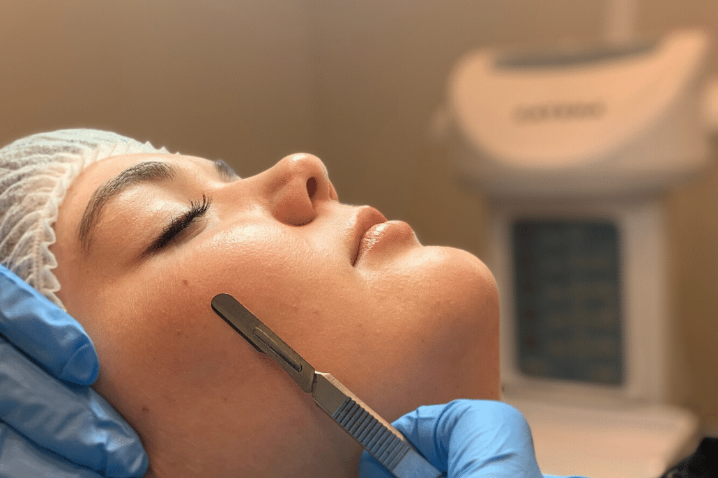 Dermablading Skin Treatment: Is it right for you?