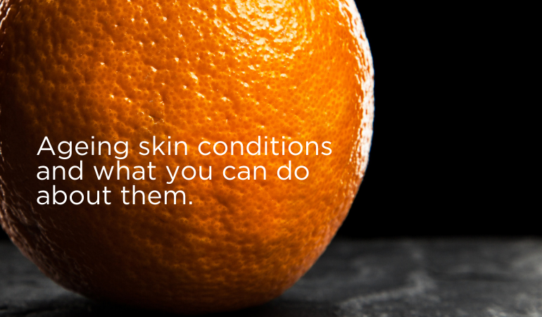 Your guide to the best treatment solutions for ageing skin concerns