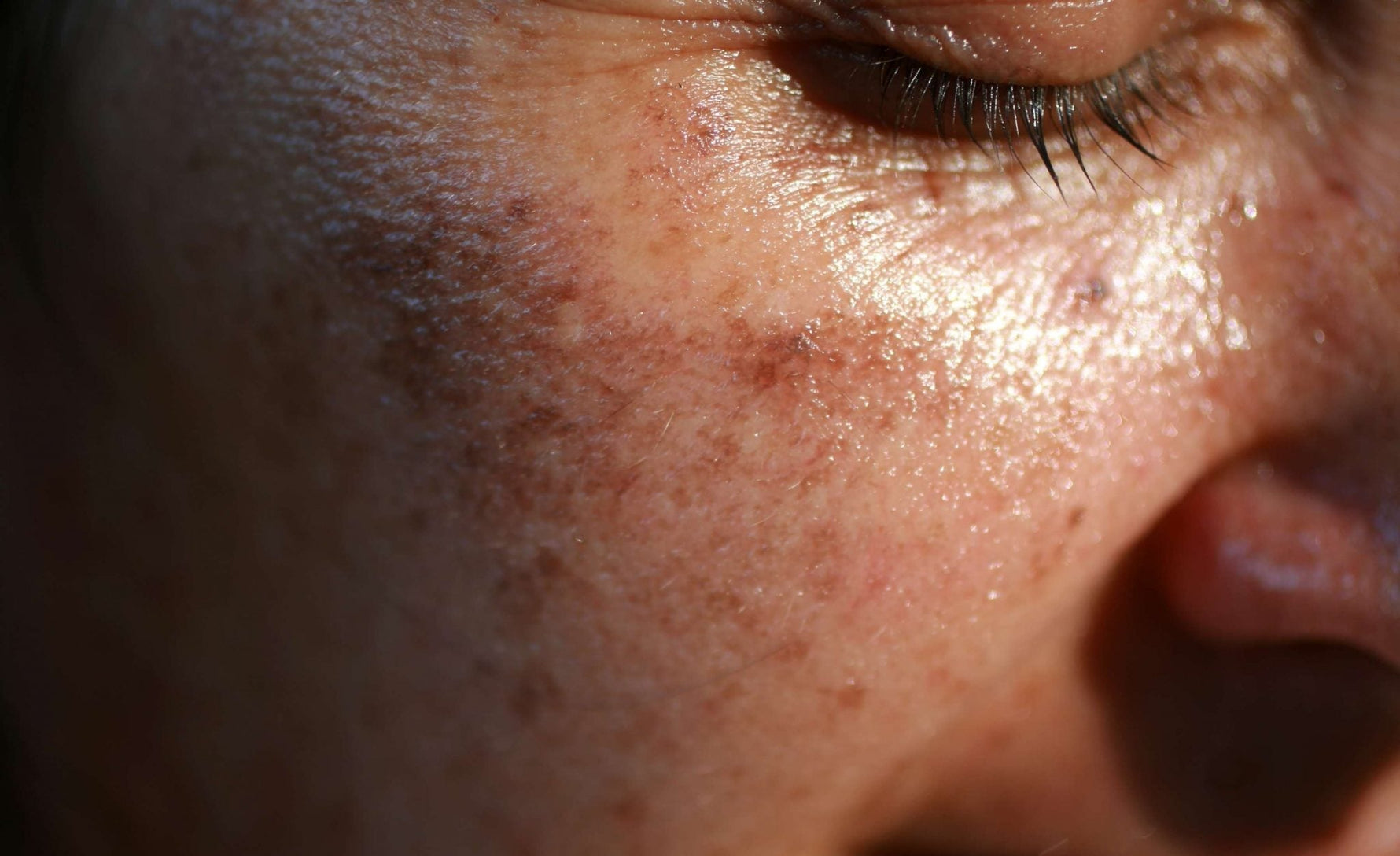 Yes, you can reverse sun damage