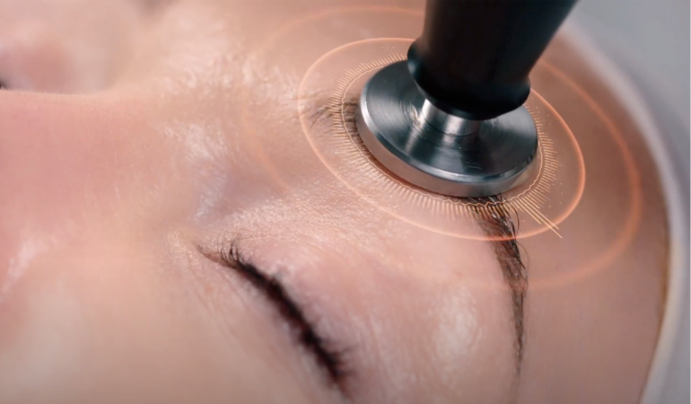 Sonophoresis Facial – Vitamin Infusion Treatment