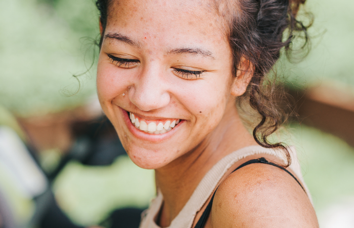 Conquering Teenage Acne