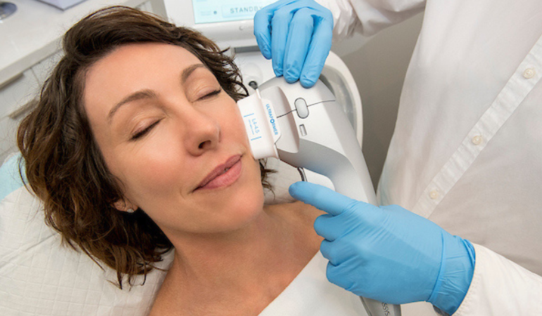 Ultraformer III HIFU skin tightening treatment at Select Skin clinic
